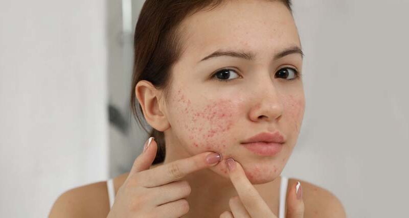 Dermatología en Medellín Ecomedic
